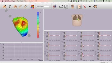 Basic usage of ECGsim