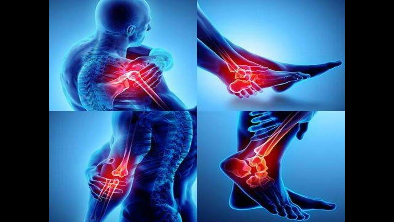 Artrivit Ulasan Suplemen Penghilang Rasa Sakit Sendi: Legit atau Scam?