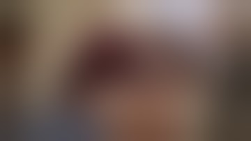 Botox/Dermal Filler Training Foundation Course | Dr Chris Hutton |  Array Academy Belfast