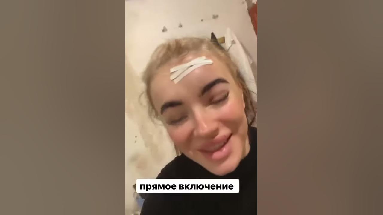 Олеся рожкова фото до пластики