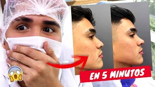 MI ROOMATE SE OPERO LA NARIZ (En 5 minutos) y así quedo 🤭