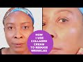 How I Reduces Laugh Lines With Collagen Cream | How I Use Collagen Cream To Reduce Wrinkles