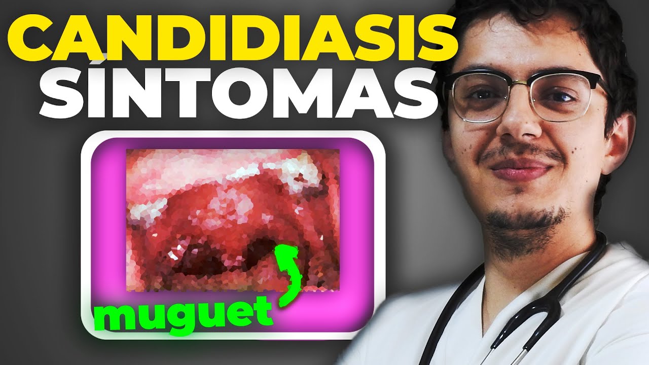 CANDIDIASIS VAGINAL y ORAL | Síntomas y TRATAMIENTO contra Candida ...