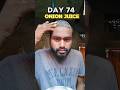 Day 74 Use Onion Juice For Hair Regrowth Hairregrowthtreatment Hairfall Day 74 Use Onion Juice For Hair Regrowth Hairregrowthtreatment Hairfall