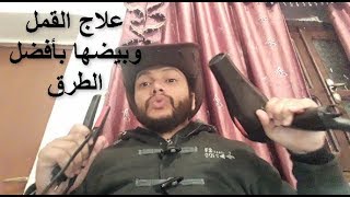 علاج القمل والصيبان والتخلص منه نهائيا بأفضل الزيوت للقضاء علي قمل الشعر عند الاطفال والكبار