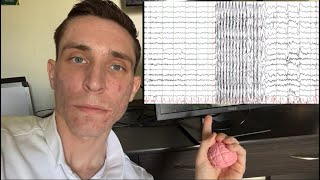 Day in the Life of a Remote EEG Technologist