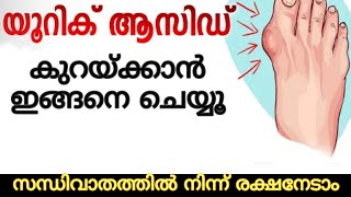 Uric acid test in malayalam