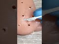 いちご鼻をキレイにするASMR