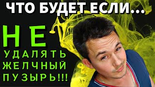 Желчекаменная болезнь | Холецистит | ЖКБ I Камни в желчном пузыре | Холецистэктомия