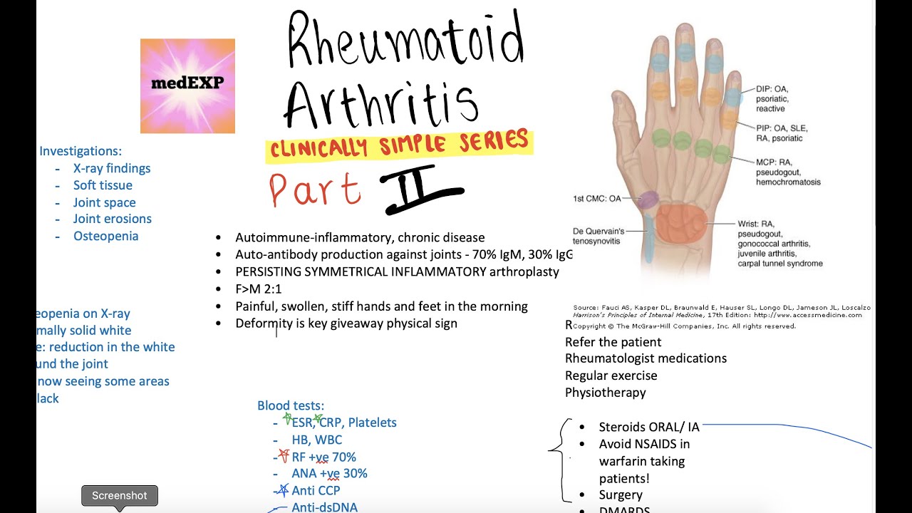 hogyan kell kezelni a rheumatoid arthritis 2 evőkanál