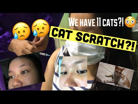 anti rabies for cat scratch