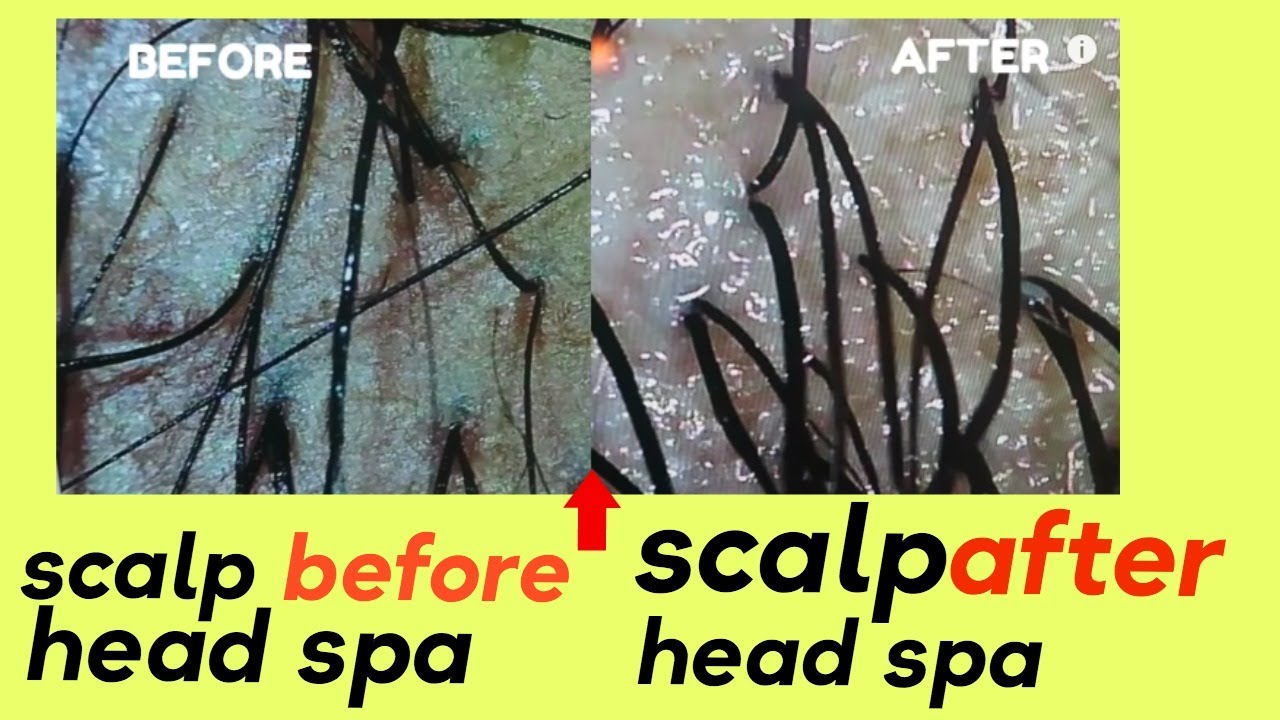 AMAZON MUST HAVE JAPANESE HEAD SPA ESSENTIALS YOU NEED FOR YOUR SCALP YouTube