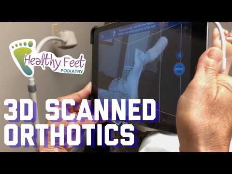 best orthotics for plantar fasciitis 218