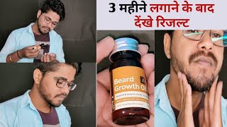 Ustraa Beard Growth Oil Result ( 3 Month Uses ) | Ft. UsefullProducts