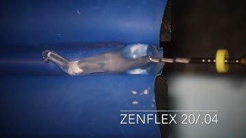 Management of curved canals using TRAVERSE and ZENFLEX rotary martensite Ni-Ti instruments