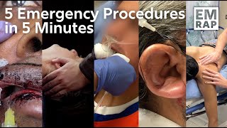 5 Emergency Procedures in 5 Minutes!