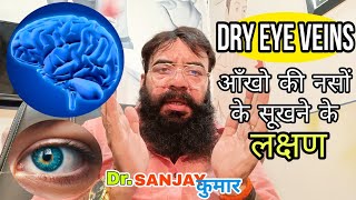 Dry Eye Veins | Aankhon ki naso ka sukhna