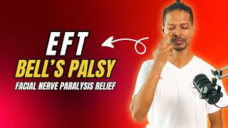 Bell's Palsy Stress Relief with Simple EFT Tapping