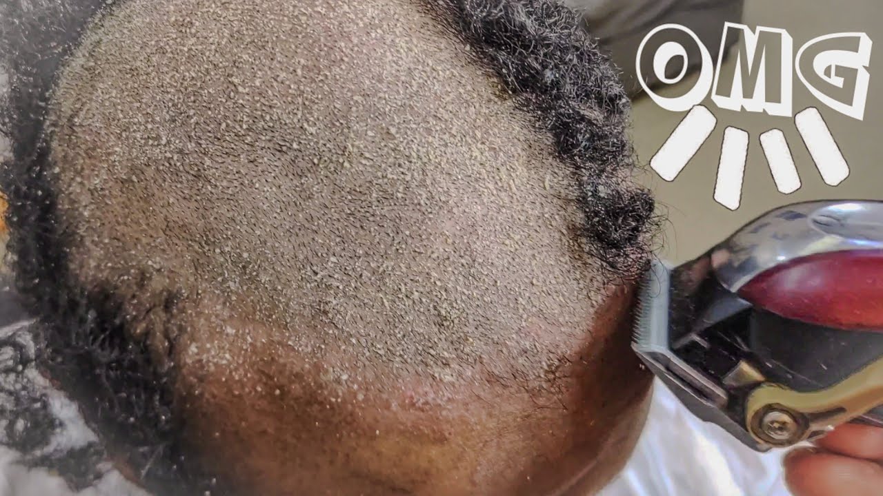 SHAVING My Dandruff Head with Clippers for Satisfying ASMR Sounds?#barbershop