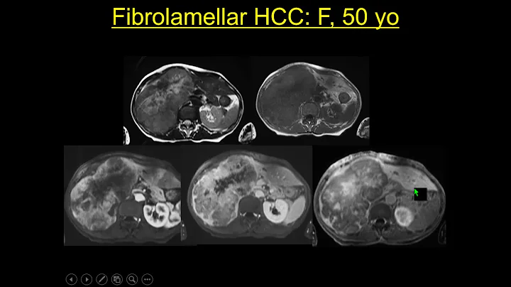 International Cancer Imaging Society Course Oct 17...