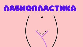 Губища, губы, губки - гинеколог о лабиопластике, 1 часть. - Др. Елена Березовская Губища, губы, губки - гинеколог о лабиопластике, 1 часть. - Др. Елена Березовская