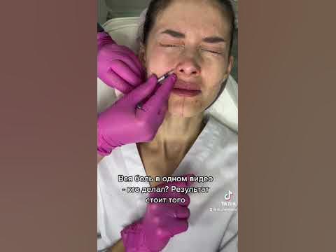 Делали ботокс в нос? Вся боль в одном видео - YouTube