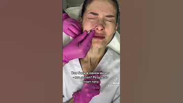Делали ботокс в нос? Вся боль в одном видео