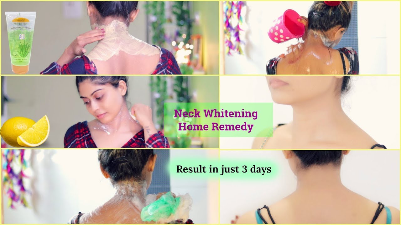 Neck Whitening At Home | How To Get Rid Of Dark Neck In 15 Minutes | Rinkal Soni