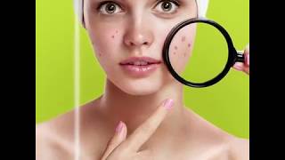 Dermaceutic 21 Days Acne Prone Kit