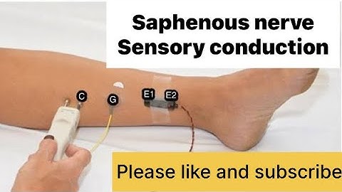 SAPHENOUS NERVE  sensory nerve #NCS #neurology #neurotech
