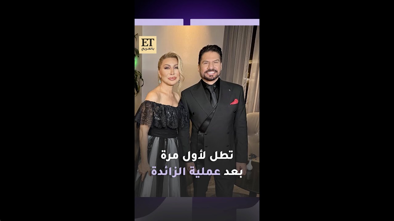 💫 نوال الزغبي تطل لأول مرة بعد عملية الزائدة في عرض أزياء وليد عطا الله