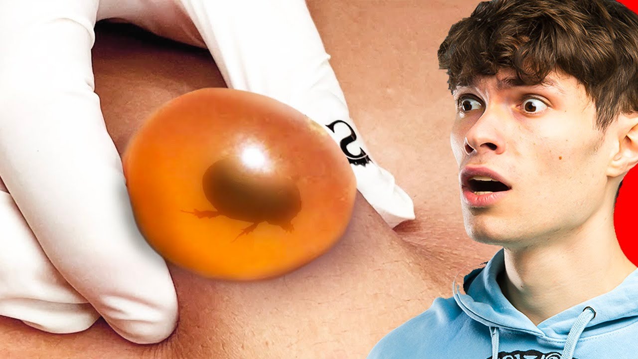 Ce Truc Vit SOUS TA PEAU ?!!