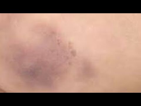 فيديو: كيف يمكنني منع انزلاق مقعدي الجلدي؟
