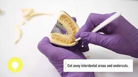 2-Step Impression with Optosil/Xantopre...  - Part...