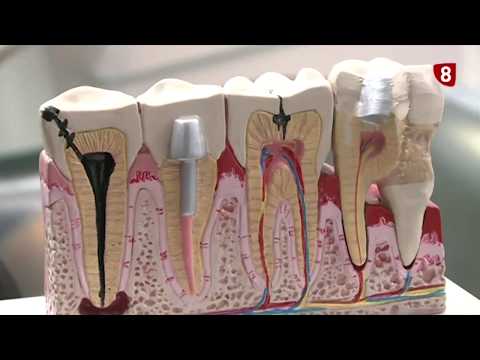 Video: Gingivitis En Parodontitis Bij Fretten