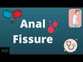 What is ANAL FISSURE? Causes, Signs and Symptoms, Diagnosis and Treatment