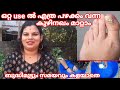 Toenail Fungus പഴക്കം ചെന്ന കുഴിനഖം ഒറ്റ use ൽ തന്നെ മാറാനും ജീവിതത്തിൽ കുഴിനഖം വരാതെ ഇരിക്കാനും