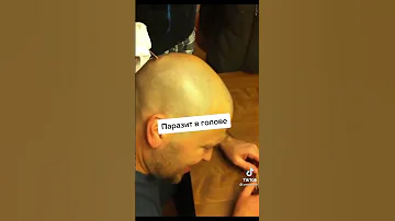 паразиты в голове