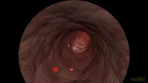 Nanobot in the Bloodstream