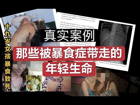 暴食真的会致命！真实案例分享 （内含图片慎入)People Who Died From Eating Disorder (video contain images may be disturbing)