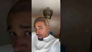 Day 3 After My Hair Transplant