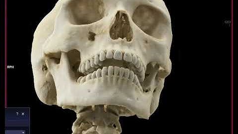 Mandible Fracture with Cinematic Rendering