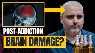 Lost Motivation To Stay Sober? - HINT It's Your Dopamine