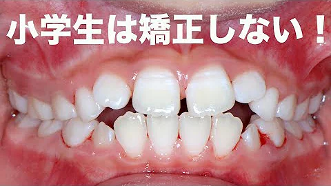 歯列矯正 女の子 تحميل Download Mp4 Mp3