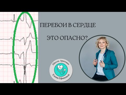 Перебои в работе сердца-это опасно?