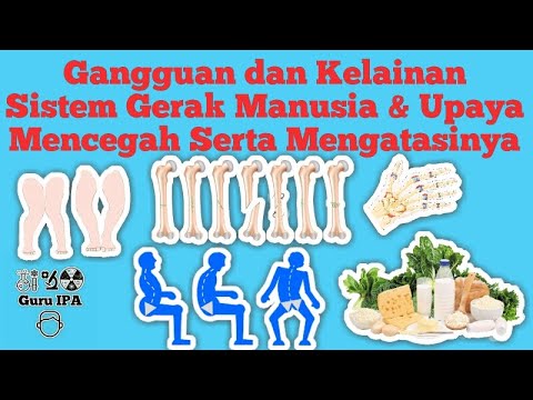 Gangguan dan Kelainan Sistem Gerak Manusia || Upaya Mencegah Serta Mengatasi gangguan sistem gerak