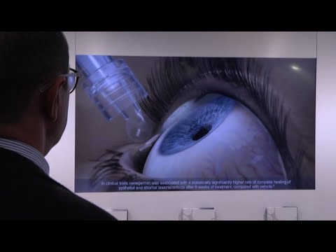 Video: Trattamento Del Glaucoma Con Rimedi E Metodi Popolari