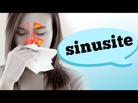 Vídeo: Sintomas de sinusite