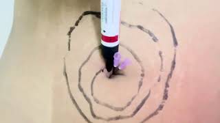 Navel Play Continues