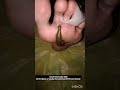Teri baton me esa uljha jiya|| leech therapy for skin problem #trendingshorts #music #newsong #love